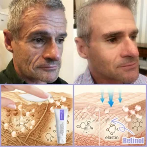 Anti-Wrinkle Skin Cream for Remove Wrinkles - Image 8