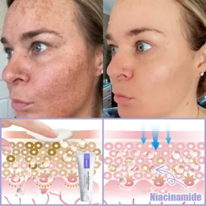 Anti-Wrinkle Skin Cream for Remove Wrinkles - Image 9