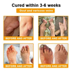 Bee Venom Pain-Relief Bone Healing Spray - Image 3