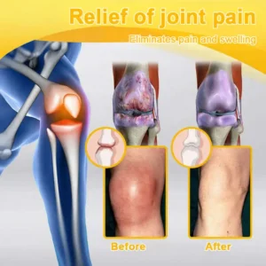 Bee Venom Pain-Relief Bone Healing Spray - Image 8
