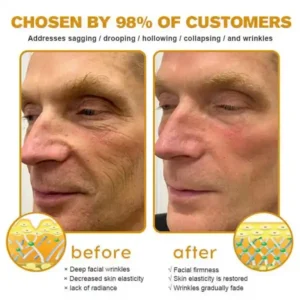 Bee Venom Awakening Peptide Eye Lifting Gel - Image 3