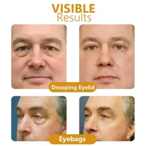 Bee Venom Awakening Peptide Eye Lifting Gel - Image 7