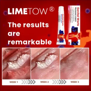 Genital Warts Remover Cream - Image 10