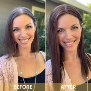 Spray-on Hair Growth Essence - Image 17