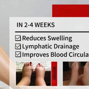 Advanced CVI Edema Restorative Cream - Image 4