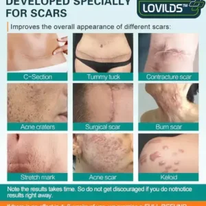 Advanced Scar Spray For All Types of Scars - Image 2