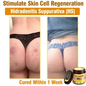 Bee Poison All-in-One Cream US Dermatologist Approved - Image 11