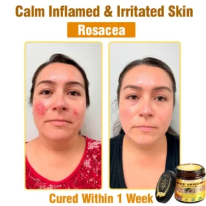 Bee Venom All-in-One Cream US Dermatologist Approved - Image 11