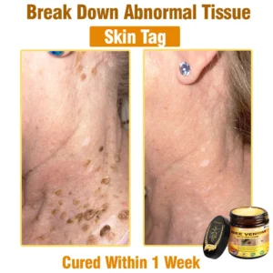 Bee Venom All-in-One Cream US Dermatologist Approved - Image 12