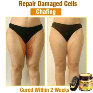 Bee Venom Cream – Anti-Aging Hydrating & Skin Repair - Image 13