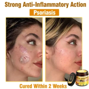 Bee Venom Cream – Anti-Aging Hydrating & Skin Repair - Image 16