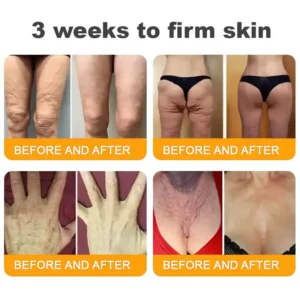 Bee Venom Cream – Anti-Aging Hydrating & Skin Repair - Image 7