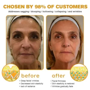 LOVILDS Bee Venom Wrinkle Removal Cream - Image 4