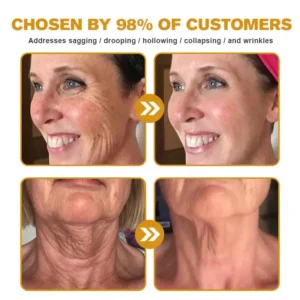 LOVILDS Bee Venom Wrinkle Removal Cream - Image 5