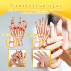 Botulinum Toxin & Bee Poison Pain-Relief Bone Healing Cream - Image 9