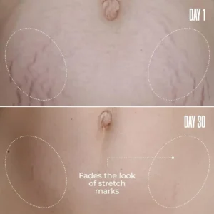 LOVILDS Cosmetics B-FLAT Belly Firming Cream - Image 2