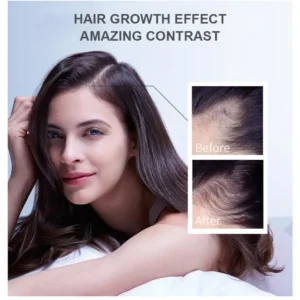 Hair Growth Essence - Image 6
