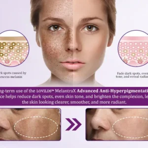 MelantraX Advanced Anti-Hyperpigmentation Essence - Image 9
