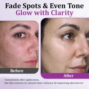 MelantraX Advanced Anti-Hyperpigmentation Essence - Image 12