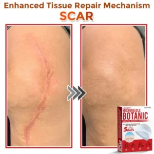 Removal Patch - Image 4