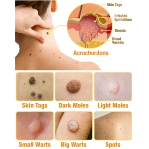 TagRecede Bee Venom Treatment Spray - Image 4