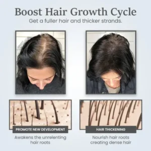 ThickTress Hair Growth Spray - Image 2