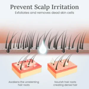 ThickTress Hair Growth Spray - Image 5