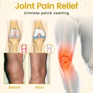 VenomFlex Bee Therapy Cream - Image 3