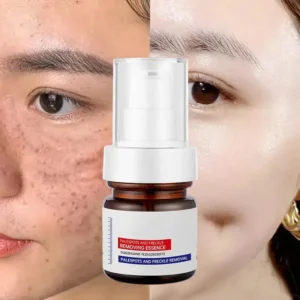 WHITENING ANDFRECKLE REMOVING ESSENCE - Image 3