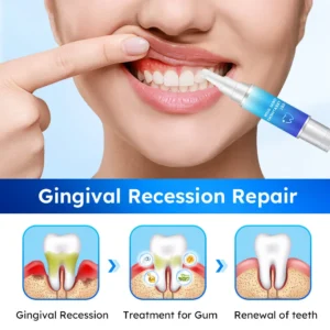 Oral Gum Treatment Gel - Image 5