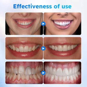 Oral Gum Treatment Gel - Image 7