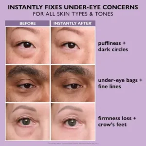 LOVILDS Eye Bag Eraser - Image 8