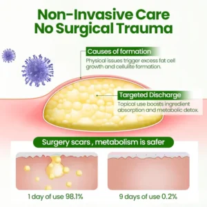KnotAway Lipoma Removal Cream - Image 4