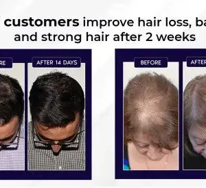 LOVILDS Natural Hair Regrowth Spray - Image 6