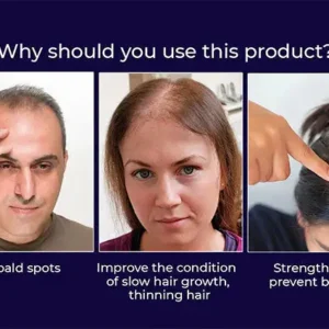 LOVILDS Natural Hair Regrowth Spray - Image 7