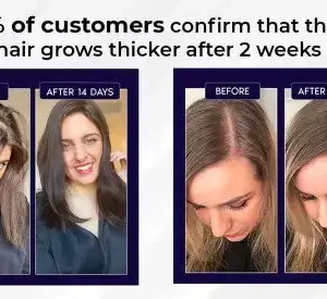 LOVILDS Natural Hair Regrowth Spray - Image 9