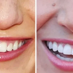 Advanced Dental Care Toothpaste - Image 4