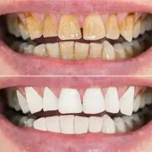 Advanced Dental Care Toothpaste - Image 5