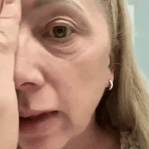 Eye Roller for Puffiness - Image 3