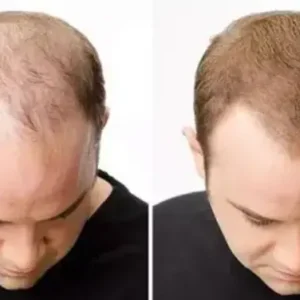Hair Restoration Spray - Image 6