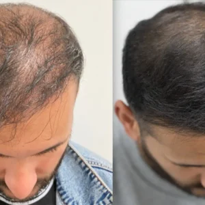 Hair Restoration Spray - Image 7