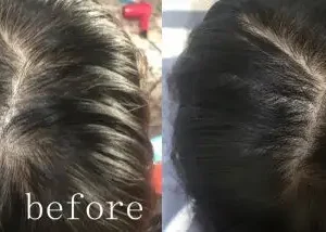 Hair Restoration Spray - Image 8