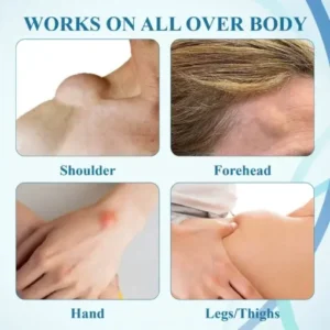 LumpsClear Lymph Say Goodbye to Lipomas and Swelling - Image 10