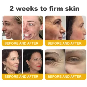 Botox Bee Venom Wrinkle Removal Cream - Image 9