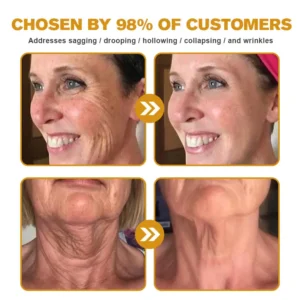 Botox Bee Venom Wrinkle Removal Cream - Image 6