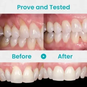 Gum Shield Therapy Gel - Image 9