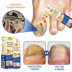 PsoriaHeal psoriasis Spray - Image 11