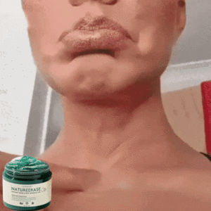 NatureErase Instant Mole & Spot Removal Gel - Image 2