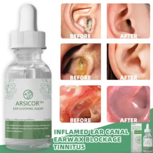 Organic Herbal Drops for Tinnitus-Hearing Loss - Image 4