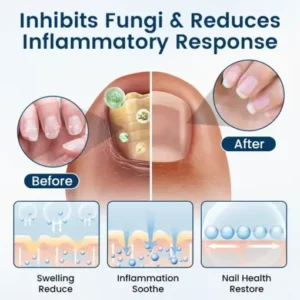 NailGuard Fungal Repair Herbal Spray - Image 2
